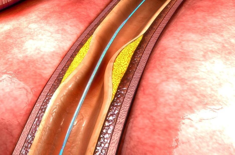 心脑血管疾病|广西106岁老人,年轻像60岁,长寿秘诀不是多运动,而是这3件事