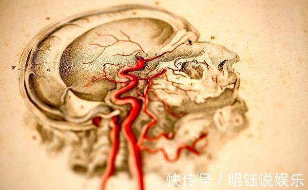 疏通血管|身体出现6个征兆,需警惕脑卒中,3招疏通血管防堵塞