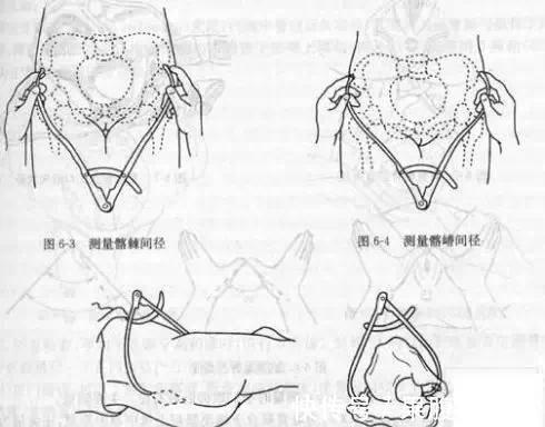 宫颈|分娩时，出现以下8种情况的产妇务必选择剖腹产，千万别犹豫误事