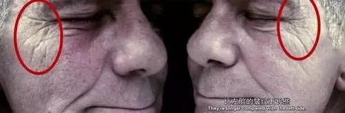 医生|少吃糖能抗衰老，使皮肤变细嫩？医生说出了真相，很多女性做错了