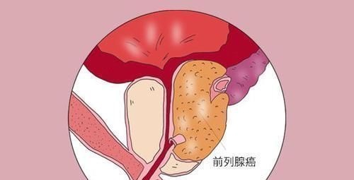 泌尿系统疾病|98岁的季羡林,患2种癌,依旧高寿,专家他的秘诀很多人做不到