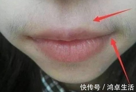 小胡子|女人有妇科病,嘴巴可能知道,3种迹象希望你没有