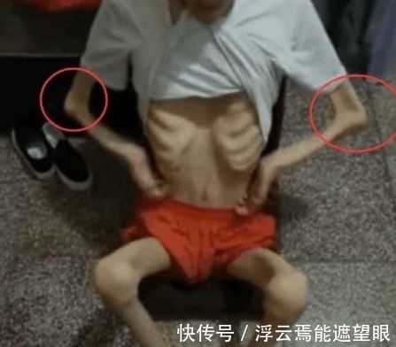 父母|16岁少年体重骤降至30斤，含泪说出凶手后，父母瘫在地上