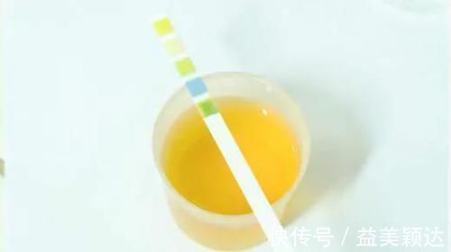 张力|尿中为什么有泡沫?泡沫尿就一定代表有肾脏病吗?医生告诉你