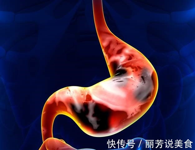 消化内科|女子头晕半年,以为患癌症,检查结果让她觉得重获新生