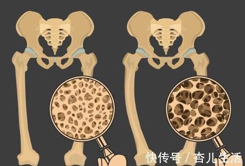 補鈣|中老年人補鈣，別再依賴大骨湯了，這六物敞開吃，骨質酥松不易犯