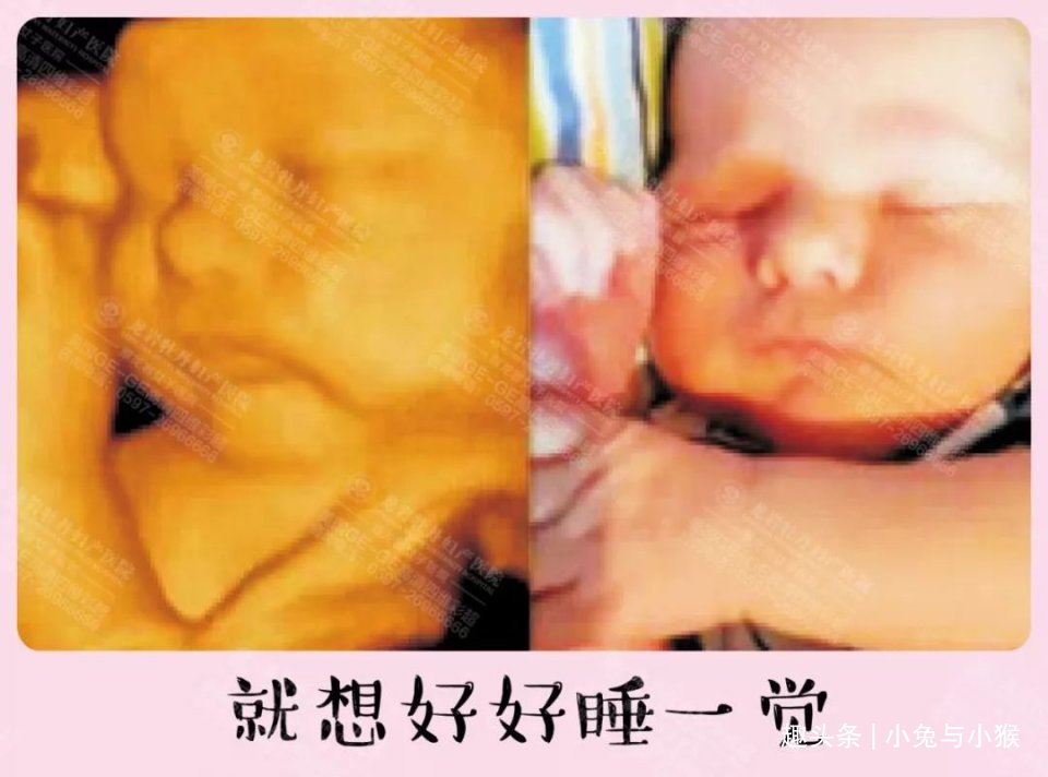 四维彩超套近乎,想得到点“关键信息”,孕妈们产检目的别错了!