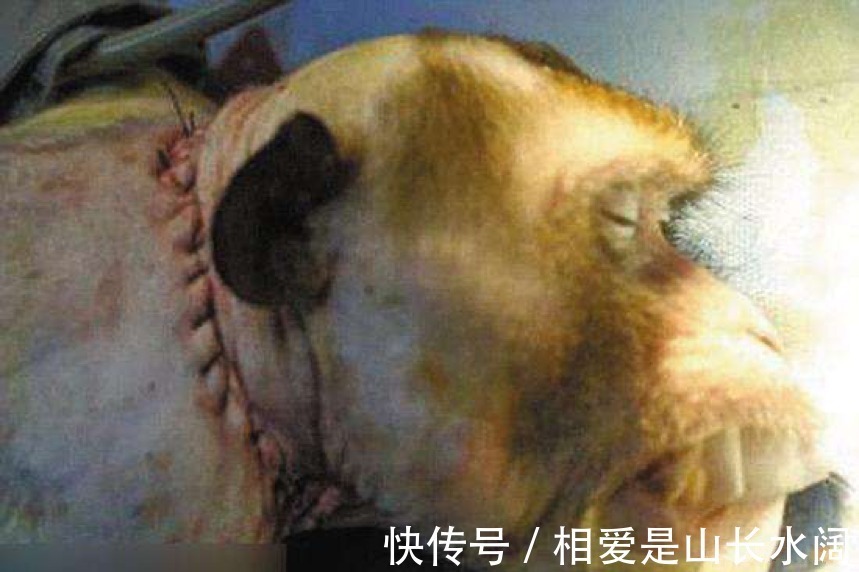 活人|世界首个活人换头手术，俄罗斯小伙自愿成为实验者，结果怎么样了