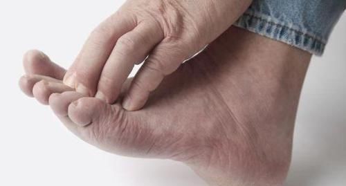 脚痒反复 脚气无非这几个原因 对症下药就好治 但要小心这个病 快资讯
