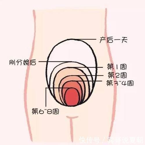 腰痛|剖腹产会有以下四个“后遗症”,多数宝妈不清楚,二胎之后才明显