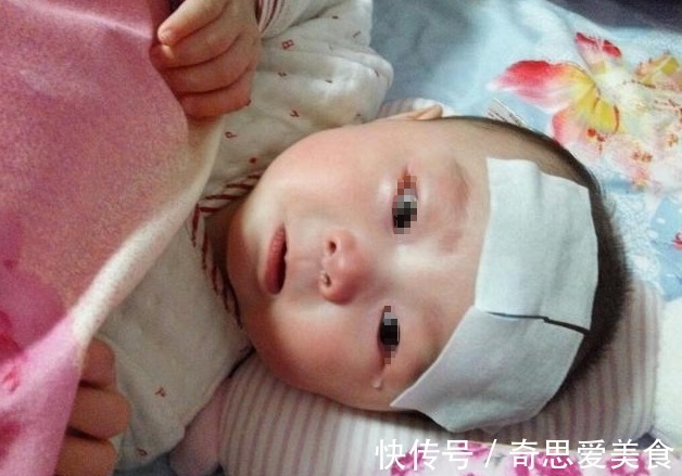 健脾|8岁男童积食3年,拖成脾胃衰竭,医生:娃有5种表现,别再拖了