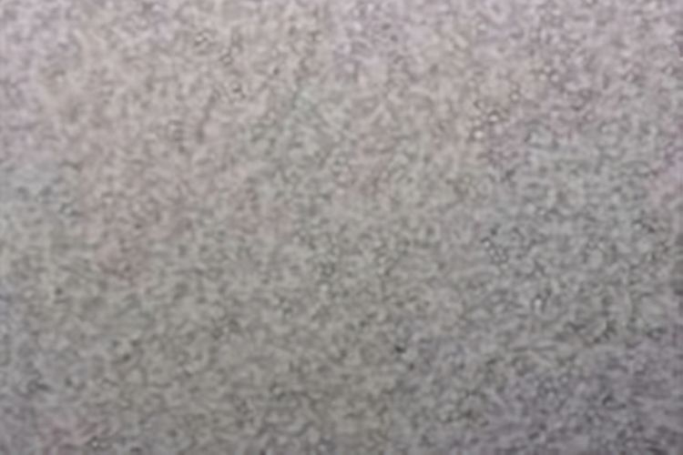 母爱|母乳本来的面目:显微镜下千倍放大,让人感叹母爱的伟大