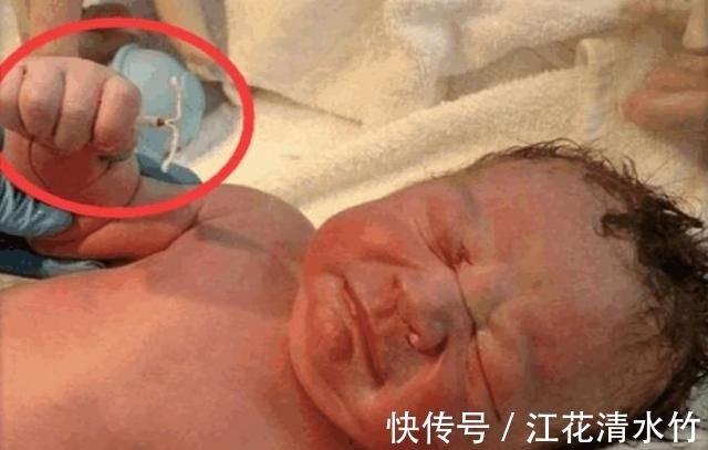 怀孕|女子怀孕生下宝宝,宝宝手中握着一样东西,医生看清后:奇迹