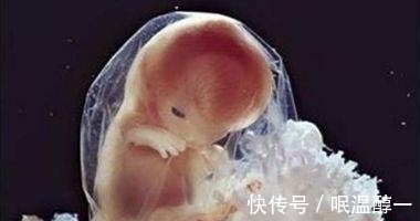 婴儿|女子终于怀孕, 医生却让打掉, 婴儿出生后, 医生直往后退