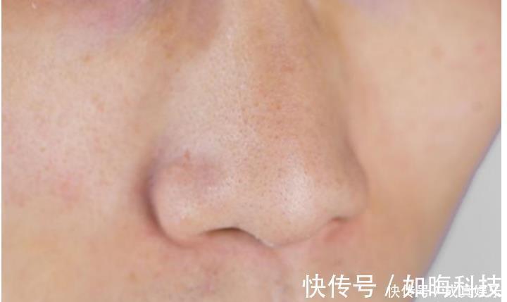 香烟|肺生病了,手和脸会出现“怪像”,如果你一个不占,肺还健康