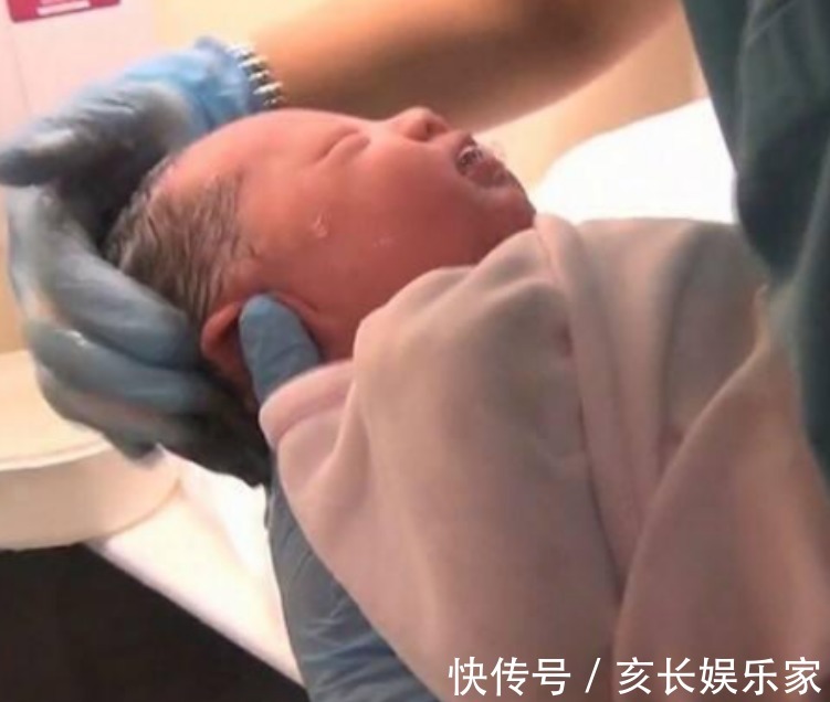 医生|怀孕7个月后胎儿停止心跳,医生取出胎儿时称 是孩子救了亲娘