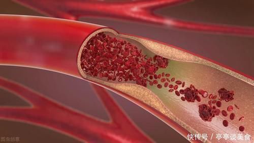 糖皮质激素|长期吃这5种药，有骨质疏松的副作用！如果你在吃，建议尽早更换