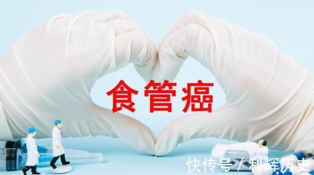 疼痛|注意,癌症早期有这些症状,早发现、早诊断、早治疗,提高治愈率