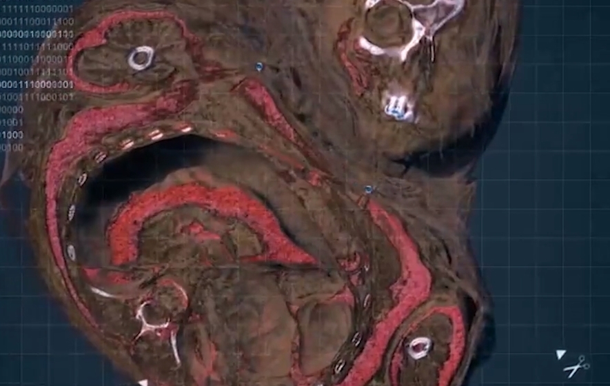 木乃伊@1999年,考古队登6700米山顶,发现冰冻500年少女,面貌完好仿佛睡着