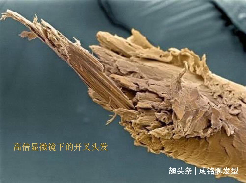 头皮 经常染发的老年人,要养成这三个养护好习惯,头皮健康不伤发