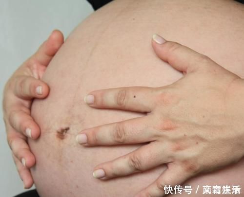 预产期|到了预产期，宝宝还不肯出来别怕，教你5招“催发动”