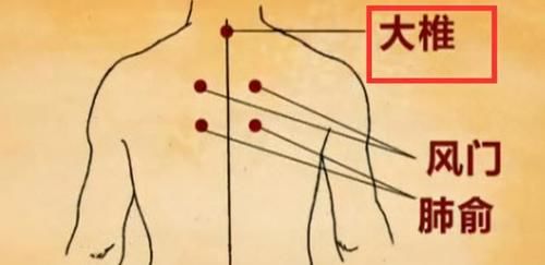 常规|孩子发热,除了常规退热,还有这些沿用千年的中医妙招