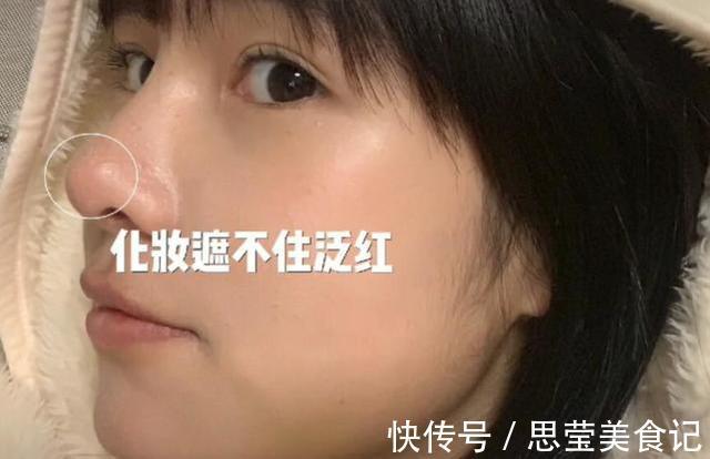 张轻轻|美女模特警告世人谨慎整容，自曝隆鼻后遗症：鼻孔流脓奇臭无比