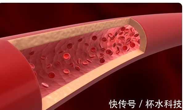 鱼肉|请停止吃这5种鱼,可能含寄生虫和重金属,看看你是否爱吃