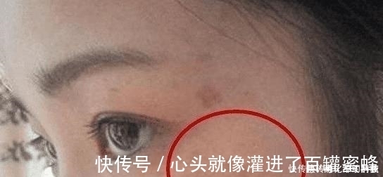 叶黄体生成素|女人患有妇科病,脸部会出现这3个暗号,发现1个就最好去查一查