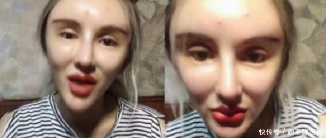 鲁豫有约|“粉红宝宝”:为了美13年整形200多次,如今只能坐在轮椅上