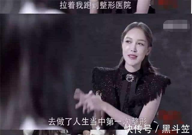 治疗 14岁时,我接受了母亲的治疗,我花了400万美元进行整形手术!