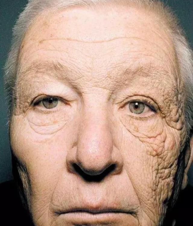 夏日|女生夏日护肤,比防晒更重要的是:晒后修复!这才是“变黑”原因