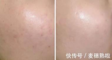 油皮 还在羡慕别人皮肤好护肤品可千万不要跟风,先看这一点!