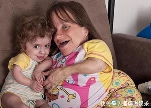 斯塔赛|身高仅71厘米的“瓷娃娃”,不顾医生劝阻连生3孩子,后来怎样了
