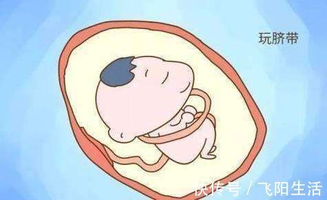 四维|四维总拍不到胎儿正脸?不想来回折腾,孕妈要提前做好这几点准备