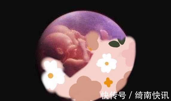 剖腹产|孕妇十月怀胎，剖腹产2小时竟生出了“怪胎”，医生恭喜你