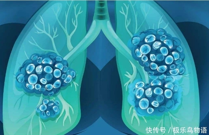 希望|“这个岁数”前若能把烟戒掉,或许肺还有希望恢复,早知道早受益