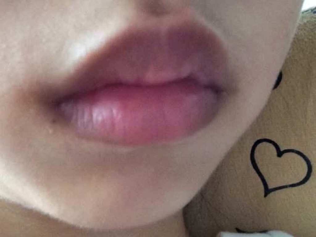 女性|女人有妇科病，嘴巴常会有几种表现暗示你，希望你一个都没有