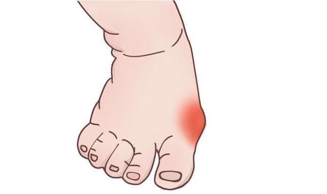 矫形鞋|宝宝的鞋子怎么买、怎么穿这几点一定要知道