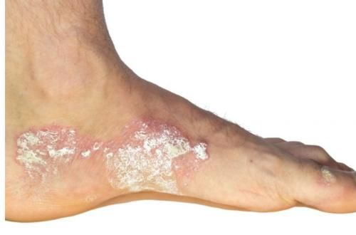 下降|肝不好，脚先知！若脚上出现5种“异常”，说明你的肝越来越差