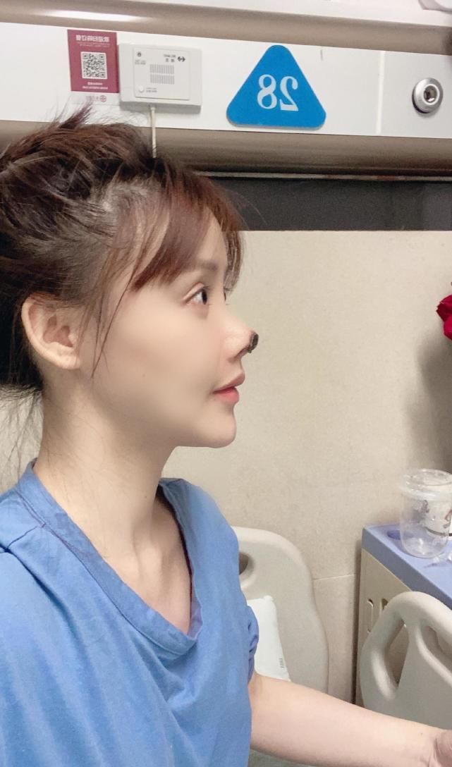 星途|又一女星整容失败,不仅星途尽毁,还面临赔付高额违约金