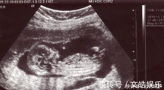 坐月子|27岁产妇二胎坐月子期间意外猝死,得知死因岳父怒将女婿告上法庭