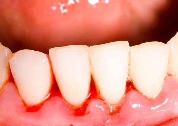 肝癌|小伙肝癌缠身，花光积蓄后离世，医生遗憾一种东西不能天天吃