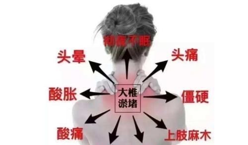 风邪|化解颈椎病的特效方,只有2味药,一补一通,谁用谁受益