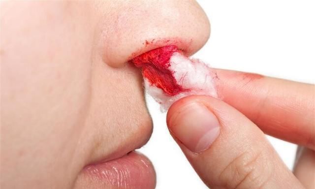 胆汁淤积|一旦身体发出7个信号,十有八九是肝硬化,最好检查一下