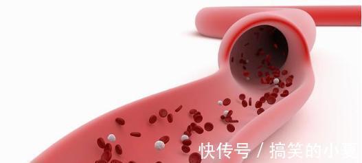 特效药|高血脂的“特效药”被发现,每天吃一点,血管通畅,血脂轻松降!