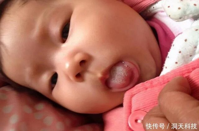 舌苔|女娃5岁积食不长个,姥姥只花了一招,积食没了,半年长高5厘米