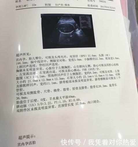 梦梦|到底能不能顺产B超单子上早已经给出答案,好多孕妈仍不会看