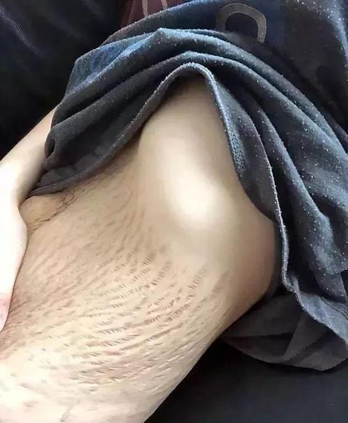 妈妈|四胞胎妈妈身材“太好”走红网络，她掀起衣服后，网友都捂住了嘴