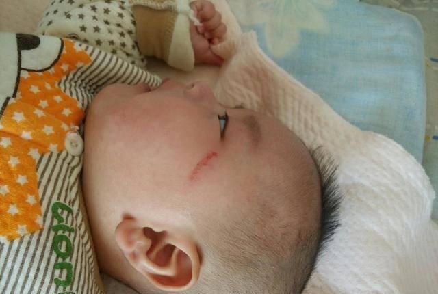 医生|4岁宝宝半夜突然流鼻血,送到医院后,医生的话让妈妈无法接受